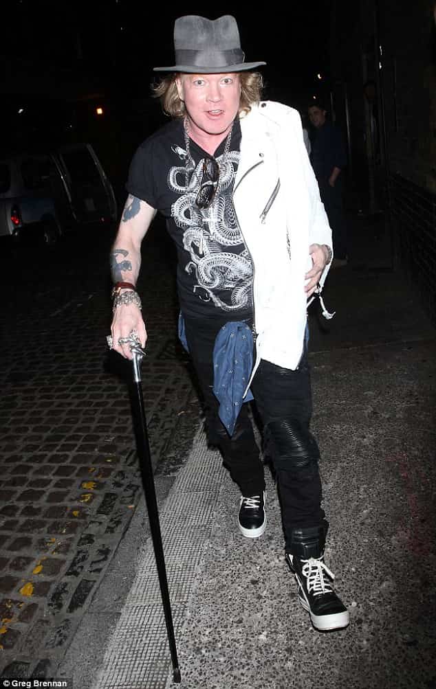 Image of Axl Rose after losing weight