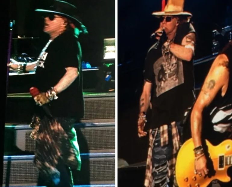 Image of Axl Rose before and after his weight loss