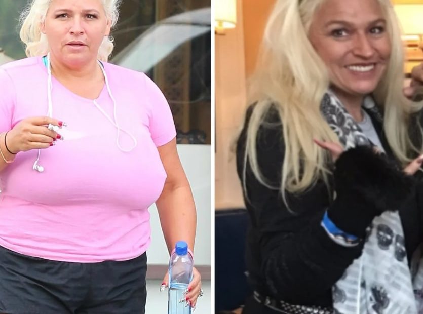 Image of Beth Chapman before and after her weight loss