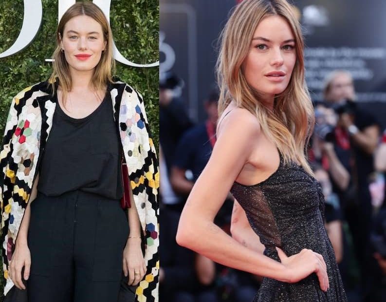 Image of Camille Rowe before and after her weight loss