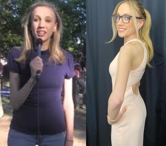 Image of Kat Timpf before and after her weight loss