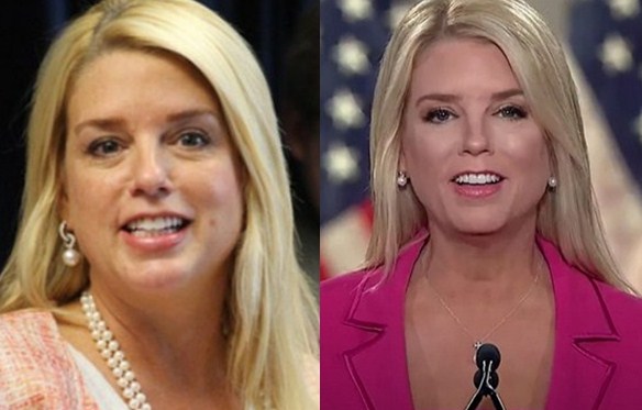 Image of Pam Bondi before and after her weight loss