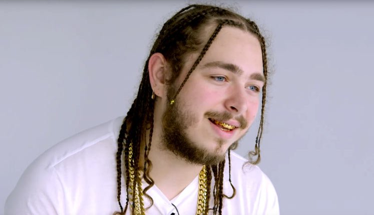 Image of Post Malone before the weight loss