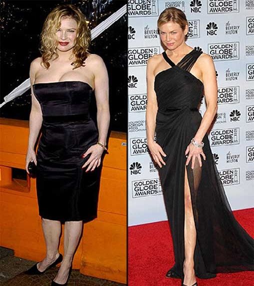 Image of Renée Zellweger before and after her weight loss