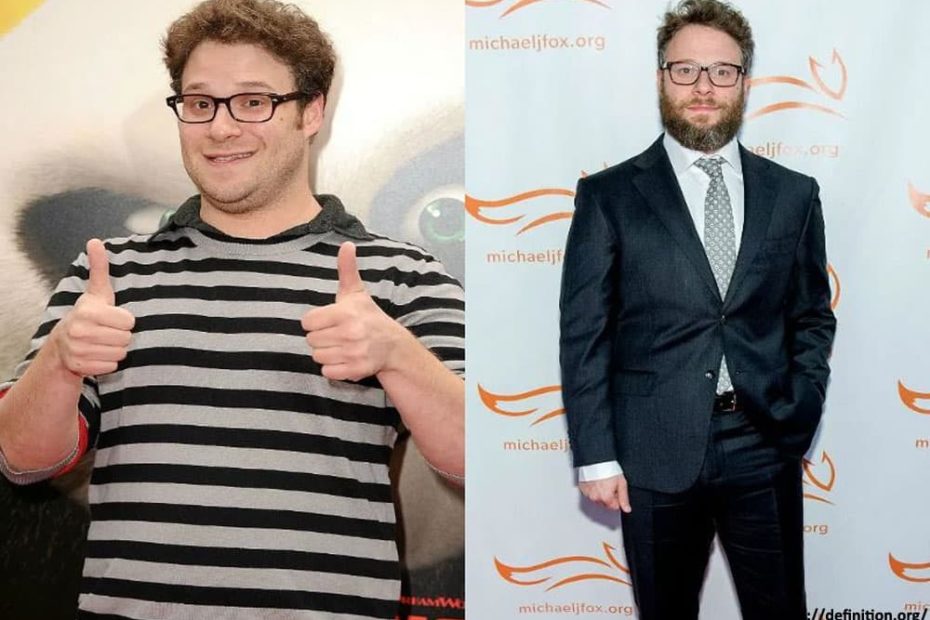 Image of Zach Galifianakis before and after his weight loss