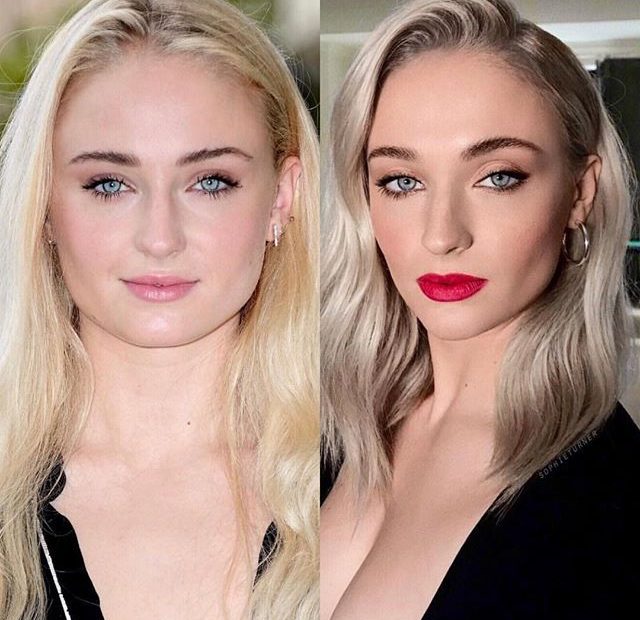 Image of Sophie Turner before and after her weight loss