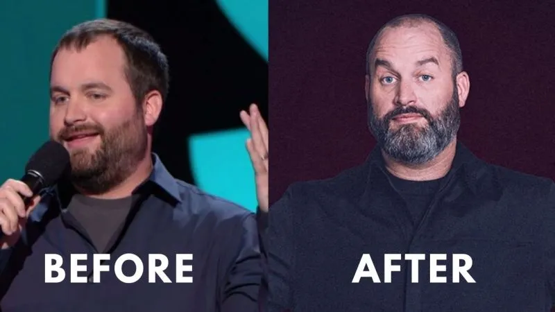 Image of Tom Segura Before and after of Weight Loss