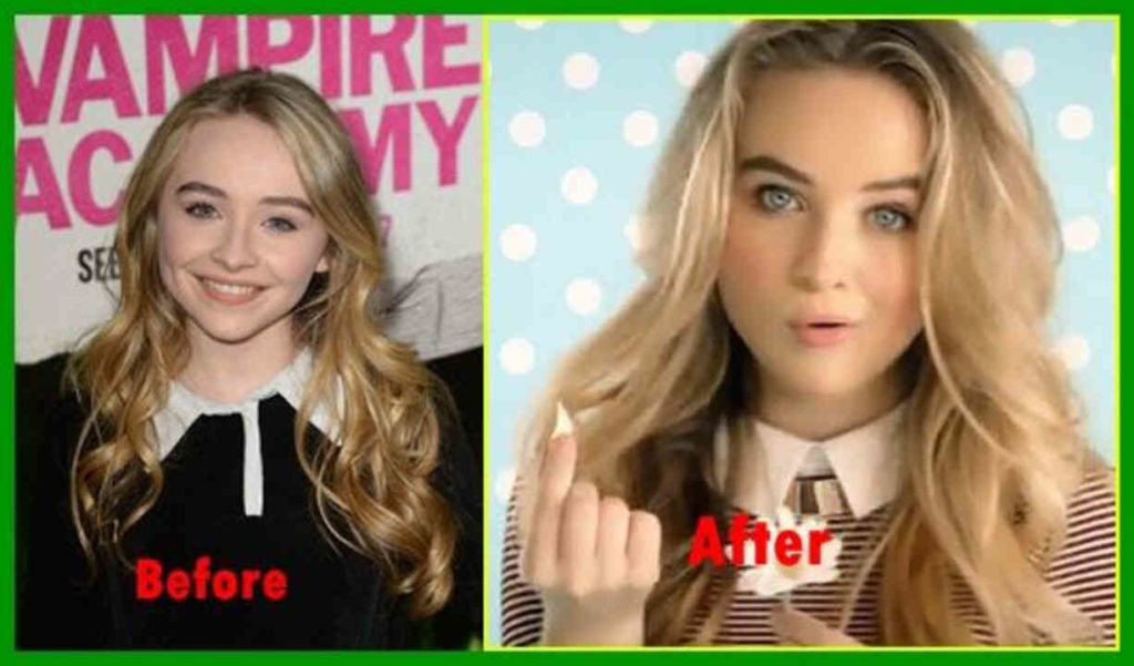 Sabrina Carpenter Before and After Looks, Current Weight, Surgery