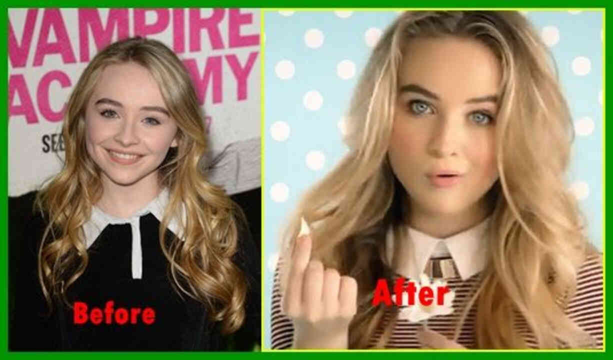 Image of Sabrina Carpenter before and after of surgery